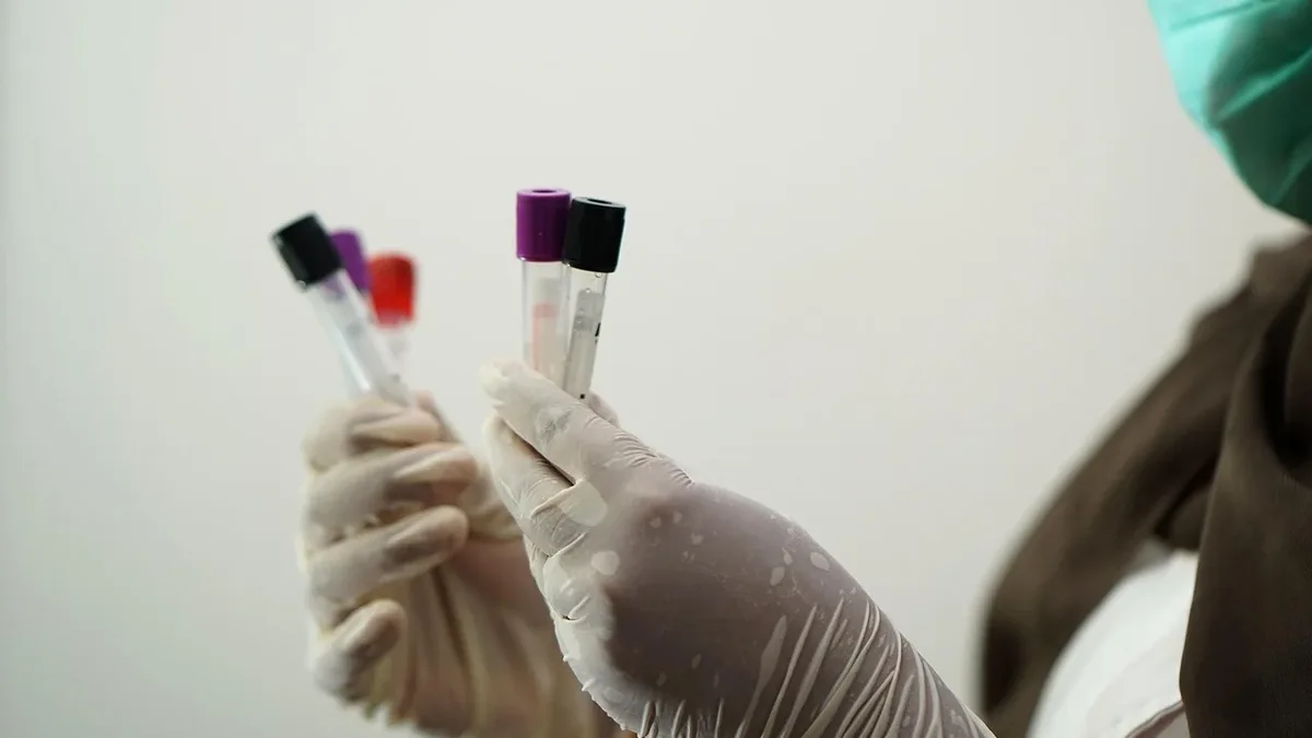 A recent patient death has raised concerns about Huidagene's transparency in clinical trials