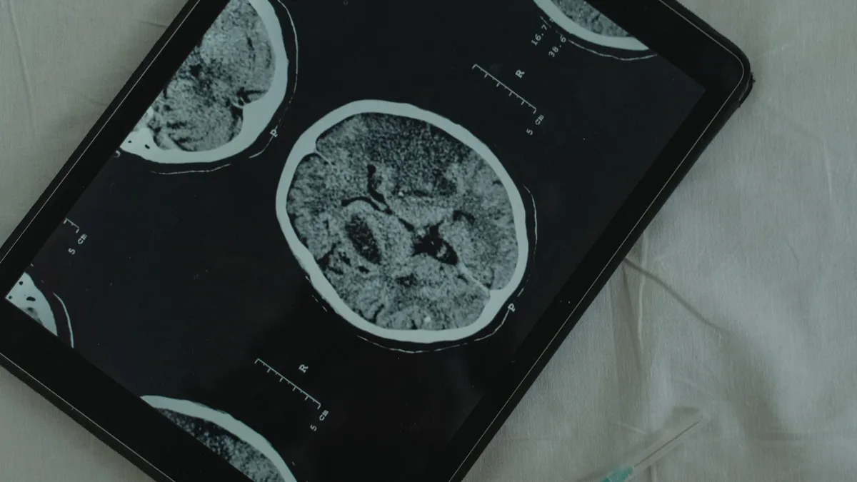 UniQure has submitted AMT-130, a gene therapy for Huntington's disease, to the FDA for accelerated approval based on...