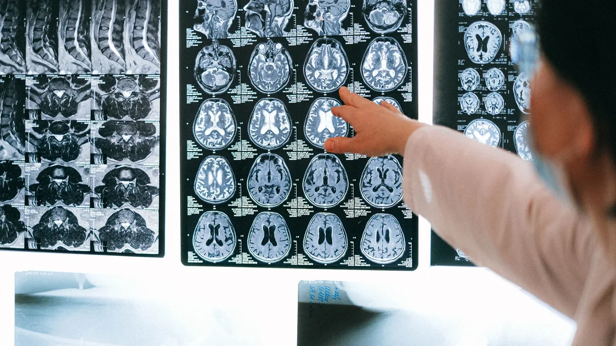 A survey by the Alzheimer's Society reveals hundreds of families wait months or years for a dementia diagnosis, impacting...