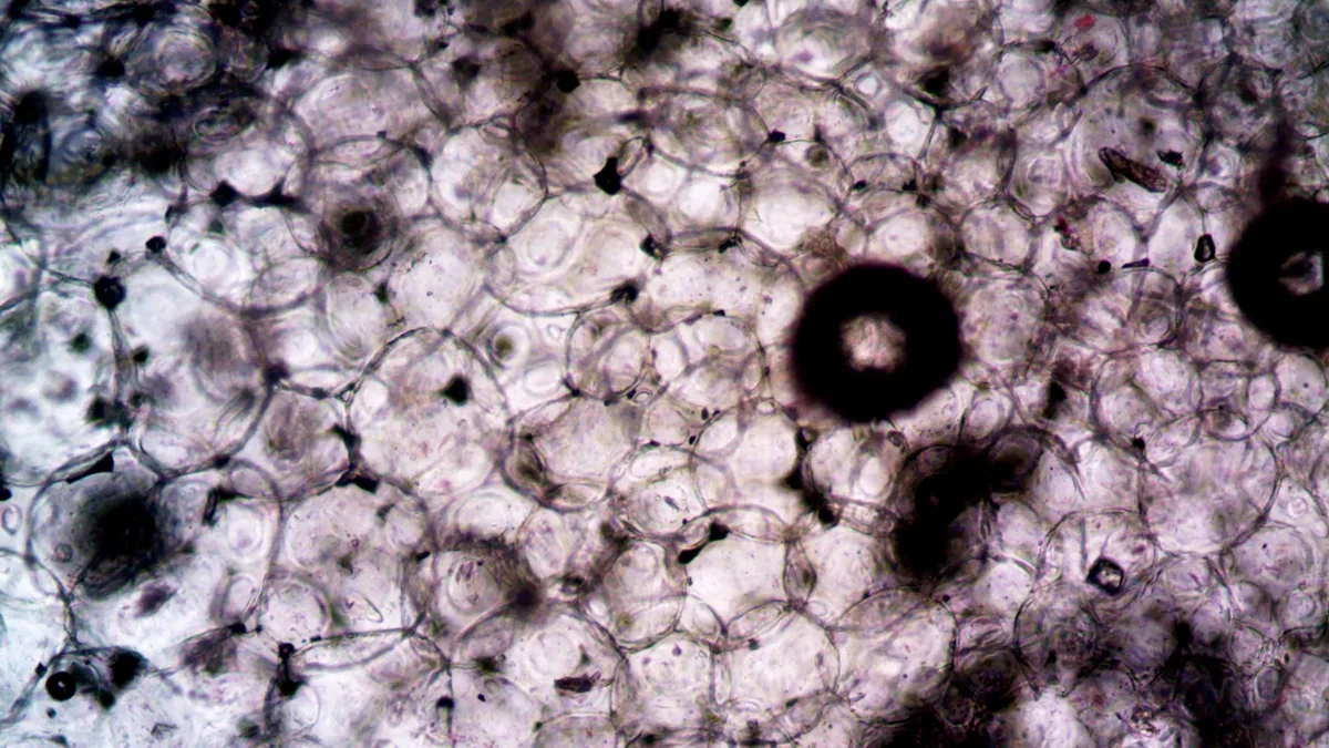 Scientists discovered metformin's main mechanism: it makes intestinal cells burn extra glucose by inhibiting...